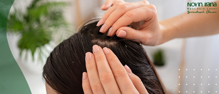 رعایت رژیم غذایی برای جلوگیری از ریزش مو پس از کاشت